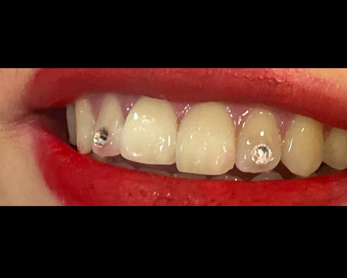 Two crystal tooth gems on a smile with bold red lip by MakeupByGen
